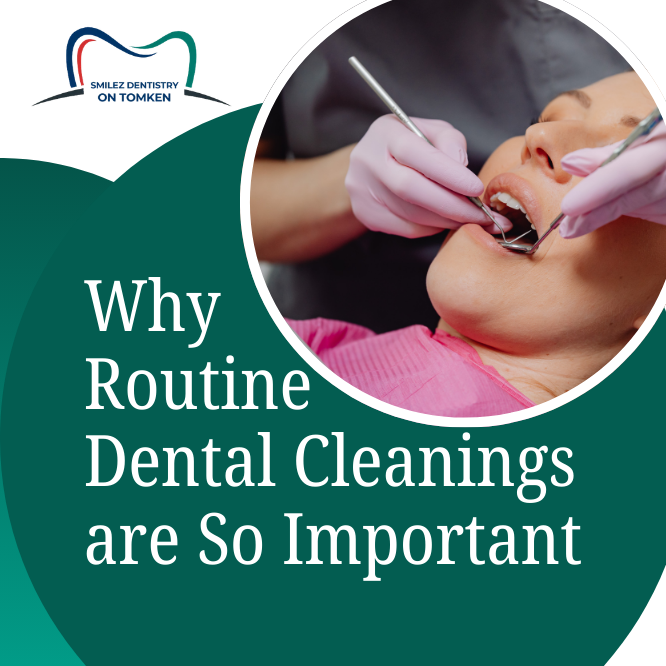 Why Routine Dental Cleanings Are So Important